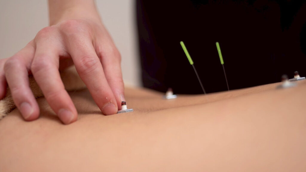 目黒区思春期頭痛治療