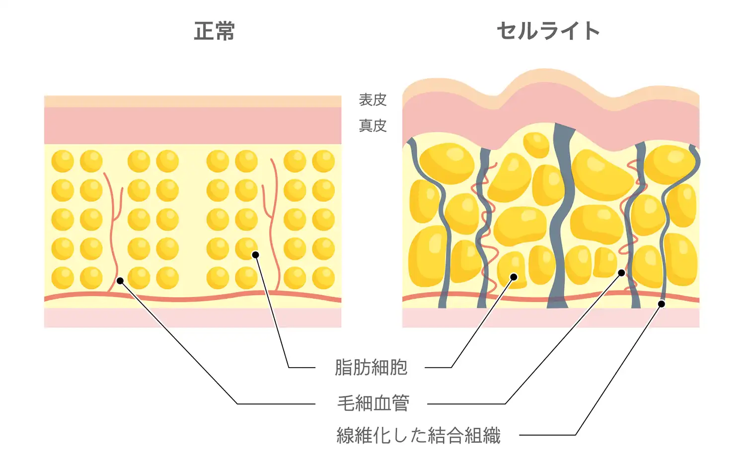 目黒区目のダイエット外来