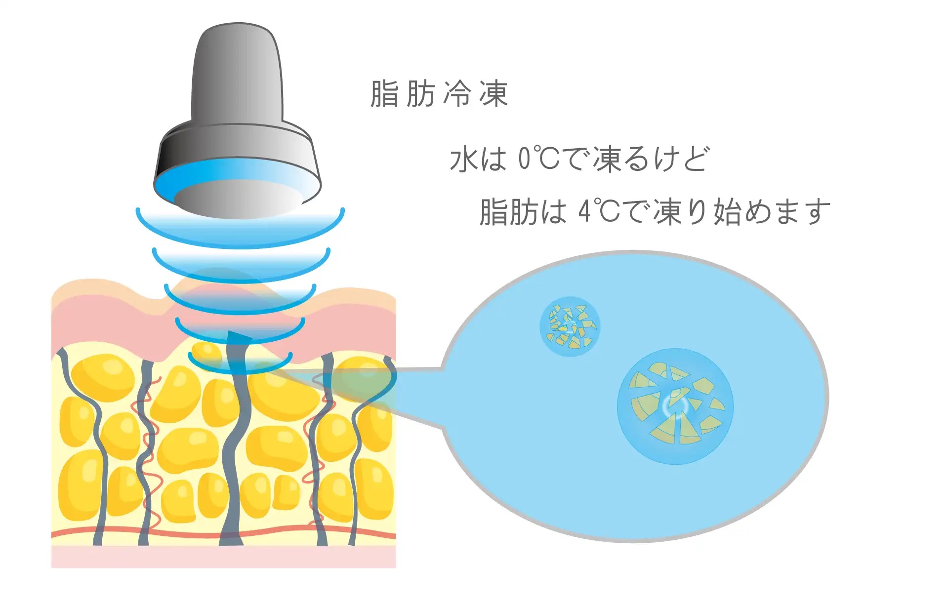 目黒区目の脂肪冷却外来